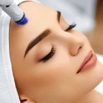 لیزر موهای زائد